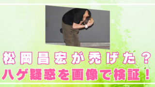 松岡昌宏　禿げた　ハゲ　髪の毛　頭　画像