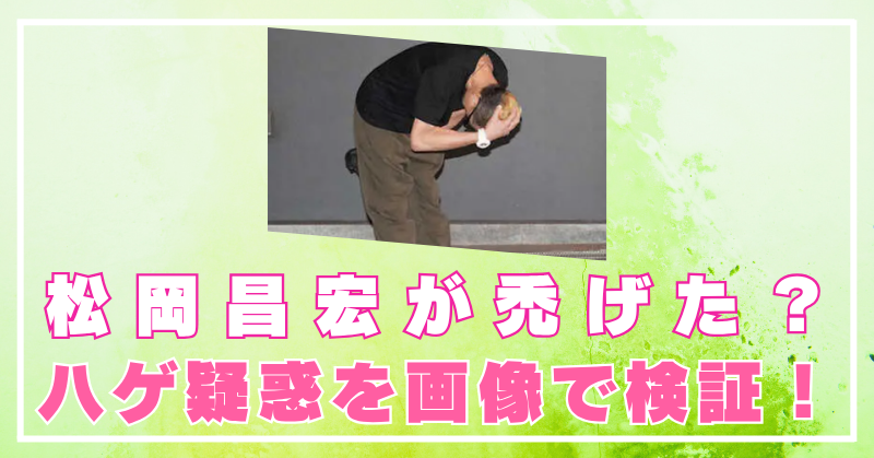 松岡昌宏　禿げた　ハゲ　髪の毛　頭　画像